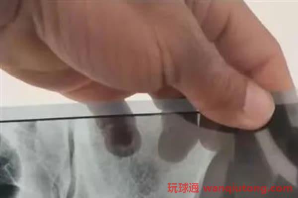 被骗到柬埔寨落入魔窟，两名中国男子冒死跳楼.....