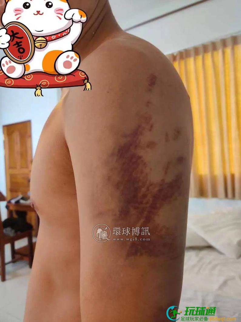 中国男子被卖缅甸遭殴打,电击!挖通道逃脱,穿越三国回国 中国男子被卖缅甸遭殴打,电击!挖通道逃脱,穿越三国回国