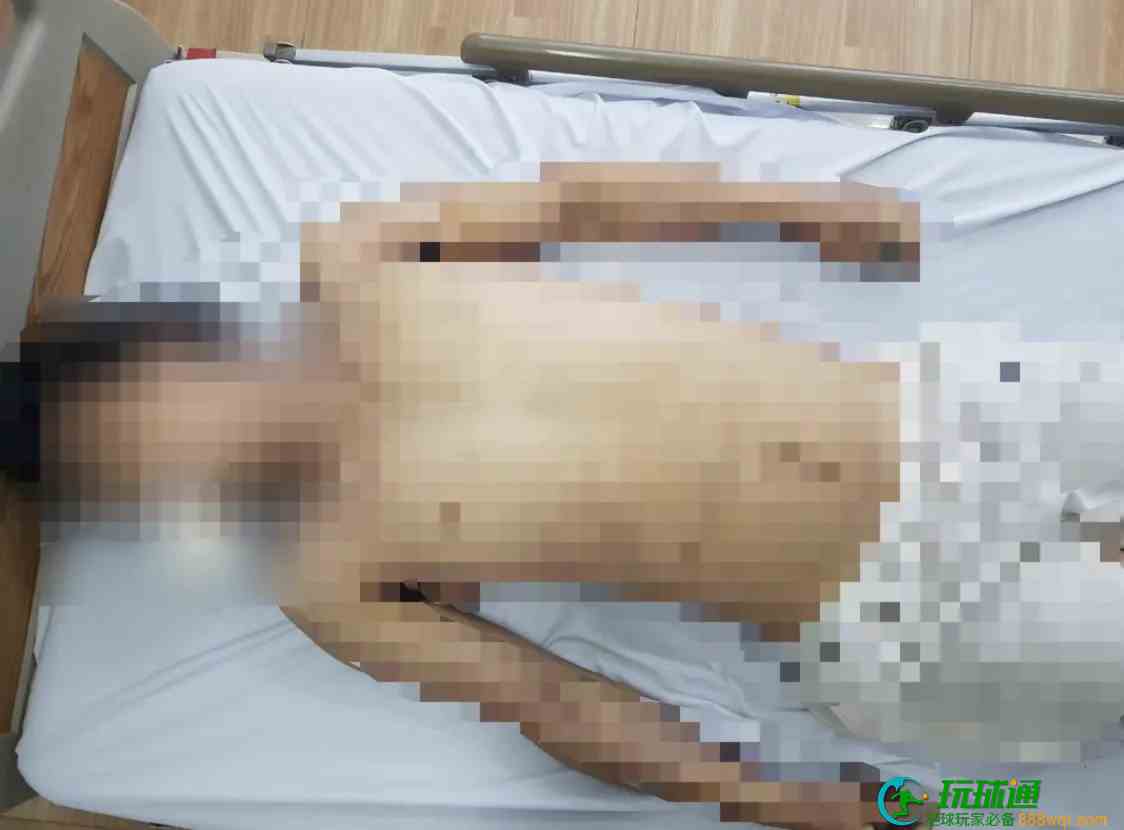 金边一中国男子酒后猝死，死因：吸毒过量！